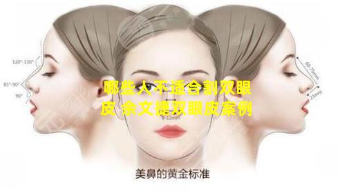 哪些人不适合割双眼皮 余文捷双眼皮案例